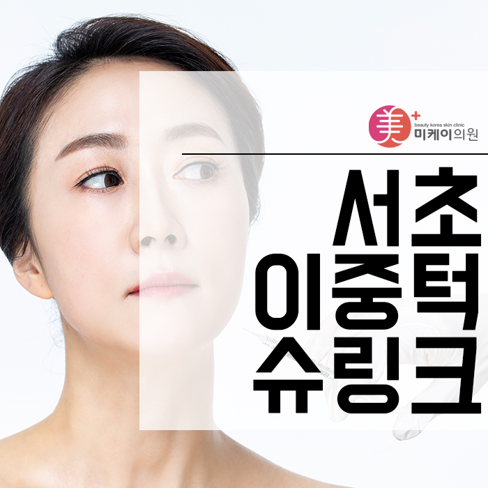 서초이중턱슈링크 날렵한 얼굴라인 만들기 관련 이미지 1