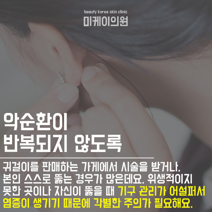 귀뚫고연고 발라도되나요? 고민하지 마세요 관련 이미지 4