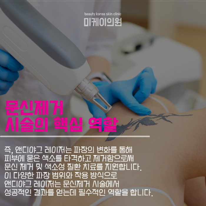 강남역문신제거 엔디야그 레이저로 아름다움을 찾다 관련 이미지 2