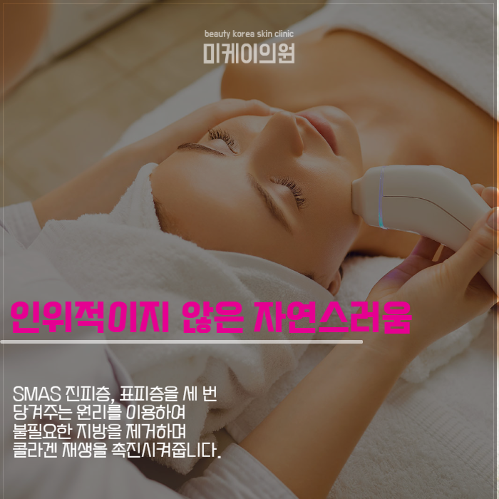 강남 인모드 이벤트 원하는 얼굴형 갖기 관련 이미지 4