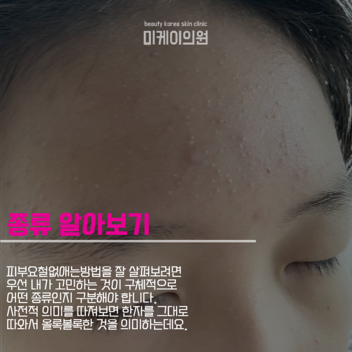 피부요철없애는방법 홈케어와 시술 모두 관련 이미지 2