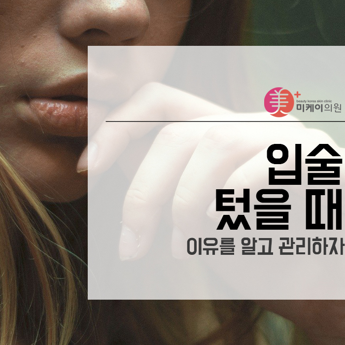 입술 텄을 때 이유를 알고 관리하자 관련 이미지 1