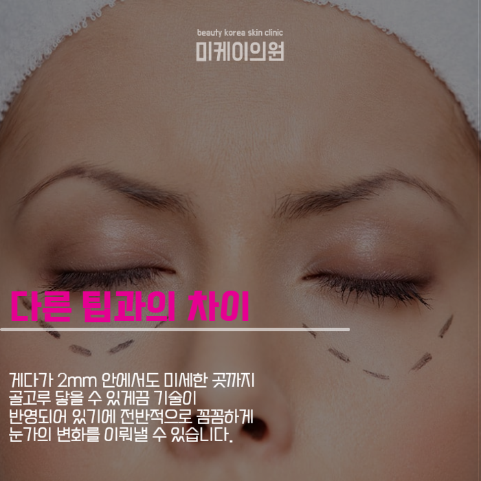 강남역아이슈링크 부분 고민 해결에 딱 관련 이미지 2