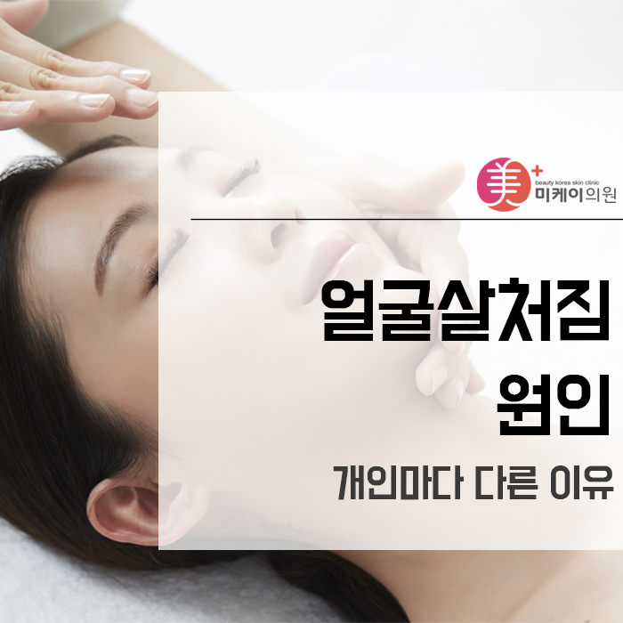 얼굴살처짐 원인 개인마다 다른 이유 관련 이미지 1