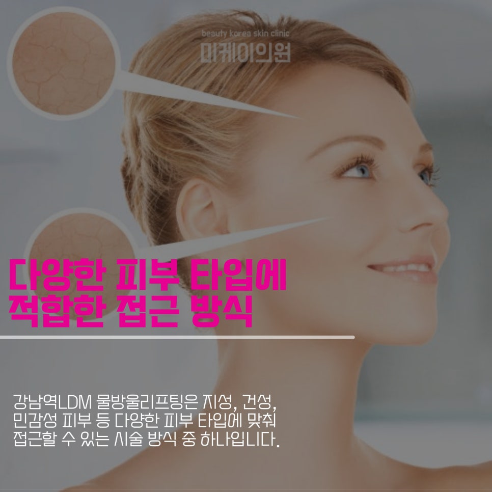 강남역 LDM 물방울리프팅으로 피부 개선을 관련 이미지 5