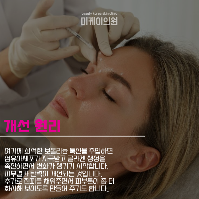 The Different Types of Skin Botox Are Different Once You Understand Them image 3