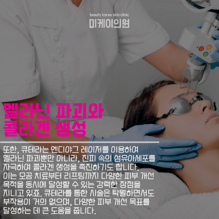 강남역문신제거 엔디야그 레이저로 아름다움을 찾다 관련 이미지 3