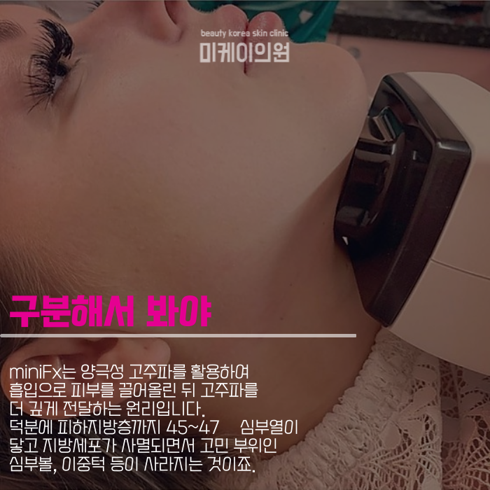 인모드fx 시술주기 맞춰야 하니까 관련 이미지 2