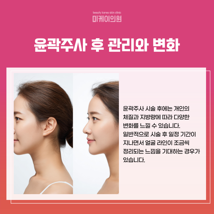 Gangnam Station Contouring Injection Clinic: Tips for Improving Face Lines image 5