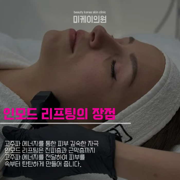 Gangnam InMode Lifting: A Customized Solution for Improved Facial Contours image 4