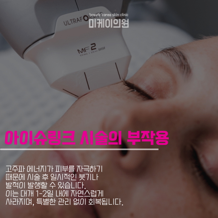아이슈링크 부작용 안전을 위한 고려사항 관련 이미지 4