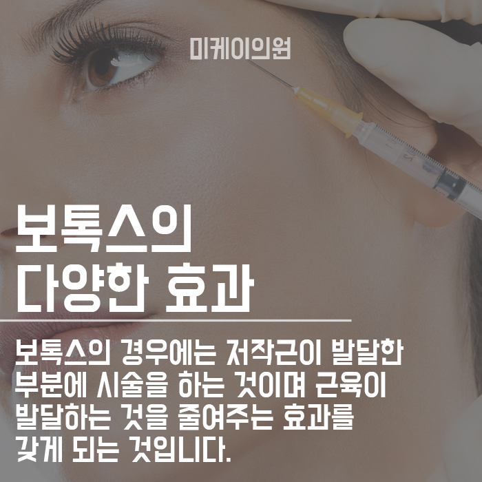50대 눈밑주름 보톡스 매끈하게 퍼져요~ 관련 이미지 2