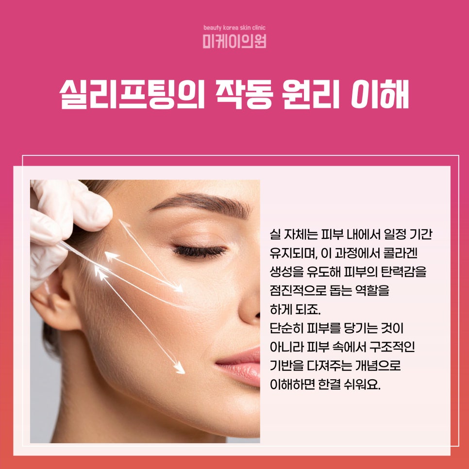 Natural Lifting at a Clinic Near Gangnam Station with Thread Lifting image 2