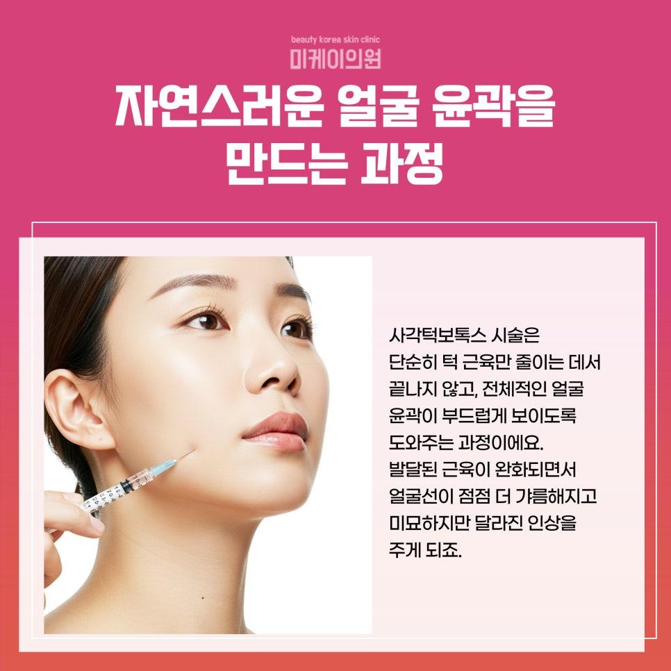 Seocho Square Jaw Botox: A Choice for Softer Facial Lines image 2