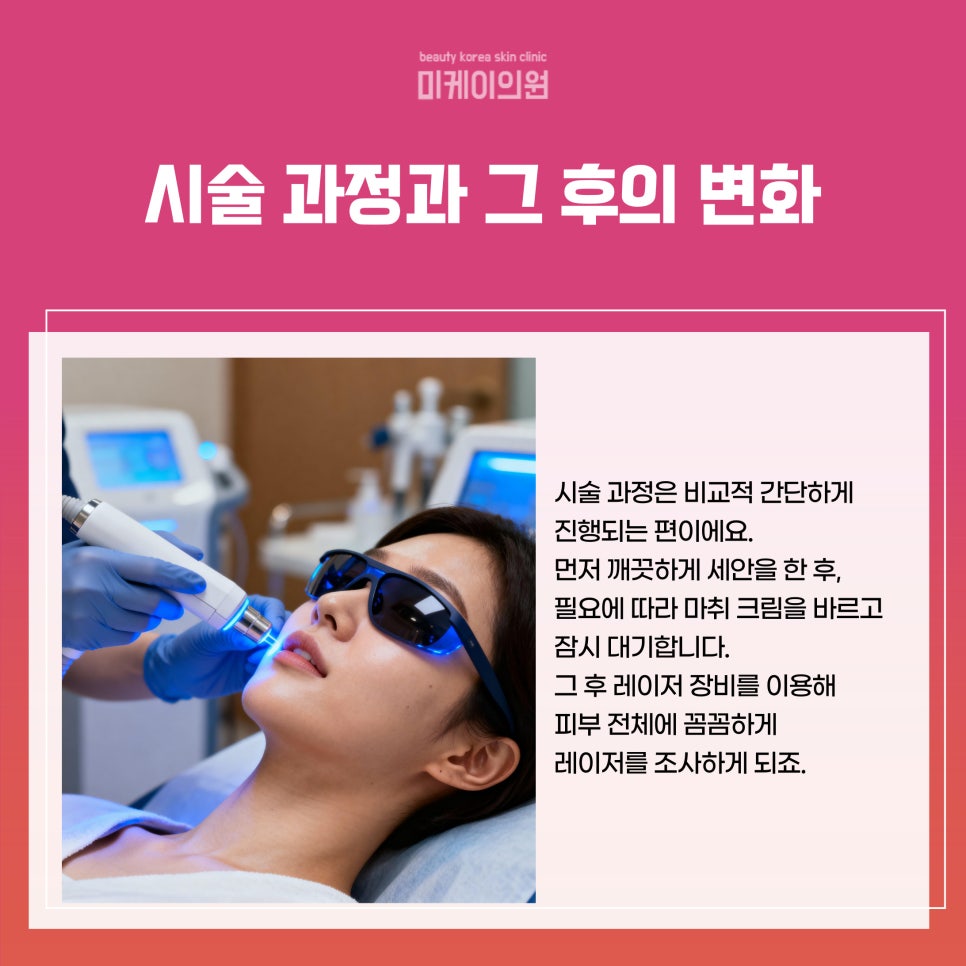 강남 피부과 레이저토닝 깨끗하고 환한 피부의 시작 관련 이미지 4