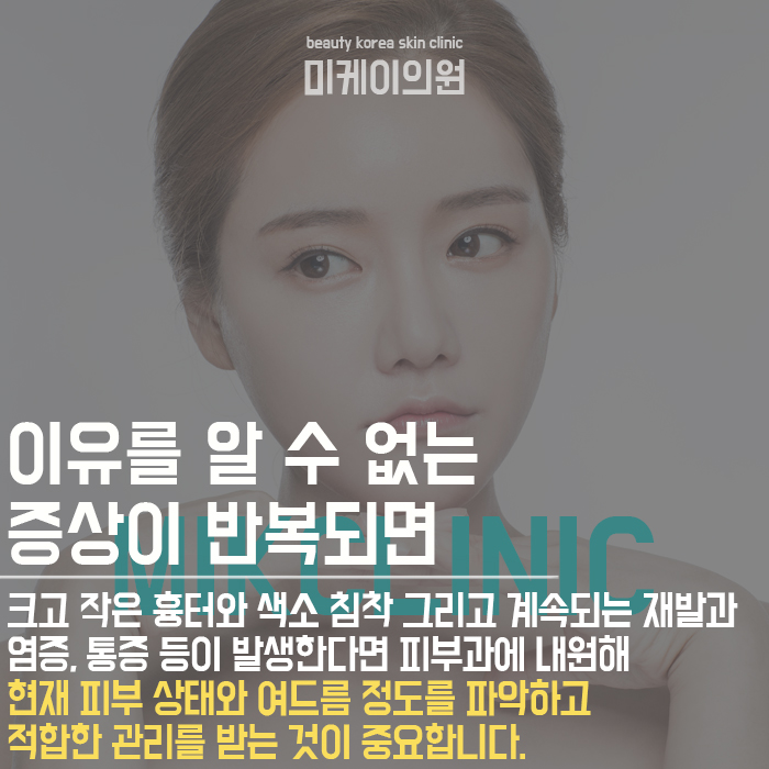 성인여드름관리방법 초기에 적극적으로 관리해야 관련 이미지 2