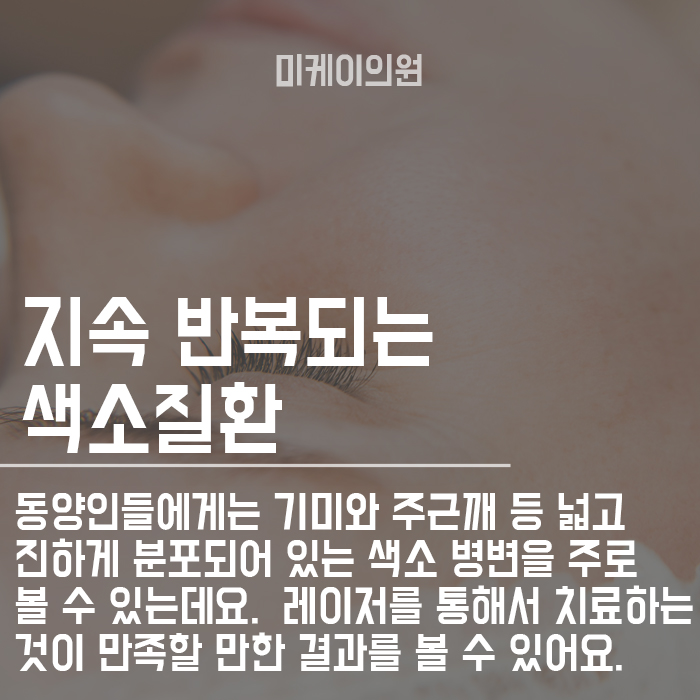 피부과색소침착치료로 맑은 피부 되찾으세요 관련 이미지 2