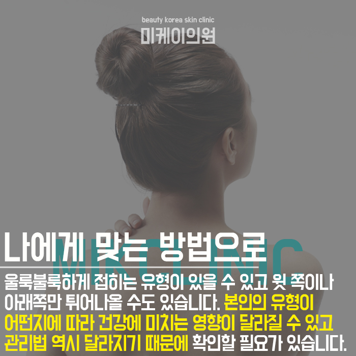 복부지방분해주사 나에게 맞는 방법으로 관련 이미지 3