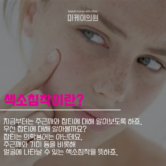 강남주근깨 얼룩덜룩해진 이유는 관련 이미지 2