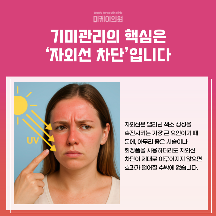 Can Melasma Be Removed in Just One Treatment at Gangnam Station? image 2