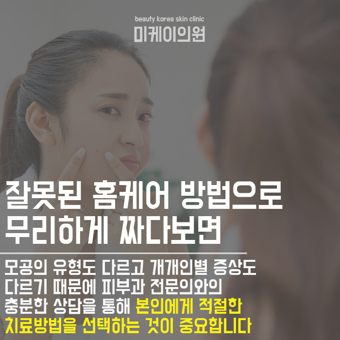 여드름압출하면모공 걱정되나요? 관련 이미지 3