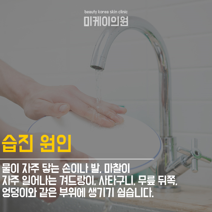 피부습진예방법 부드럽고 고운 손 만들기 관련 이미지 2