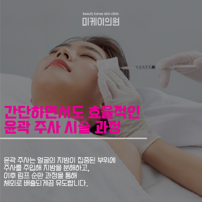 예비신부관리 윤곽 주사로 특별한 웨딩룩 준비 관련 이미지 2