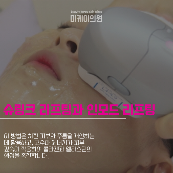 강남역 인모드 잘하는곳 원하던 얼굴탄력 만들려면 관련 이미지 3