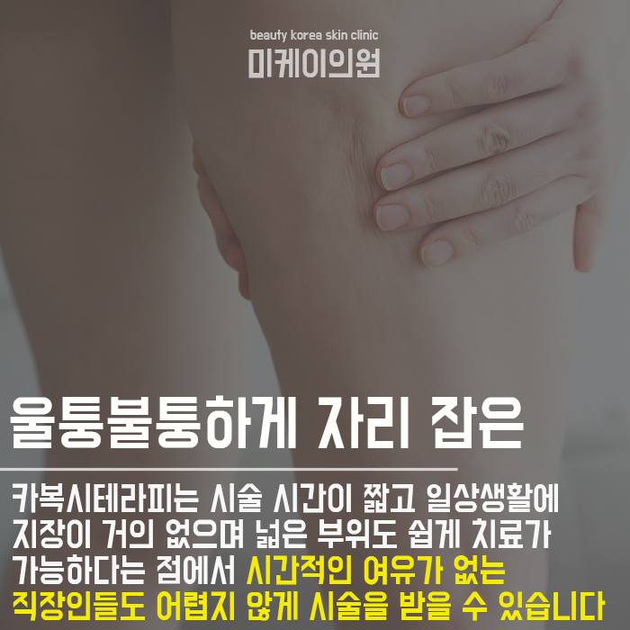 강남역셀롤라이트제거 누구나 부담없이 관련 이미지 2