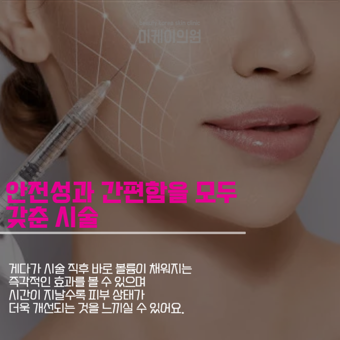 쥬베룩볼륨 원리 제대로 알고 시술받자 관련 이미지 5