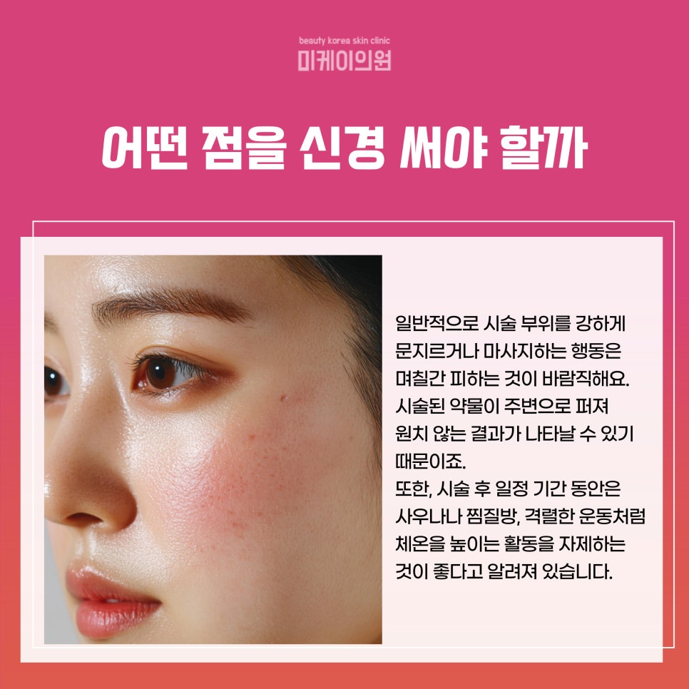 강남역 보톡스 효과 지속기간 알아보기 관련 이미지 4