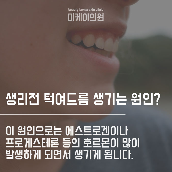 생리전 턱여드름 생기는 이유는 뭘까요 관련 이미지 3