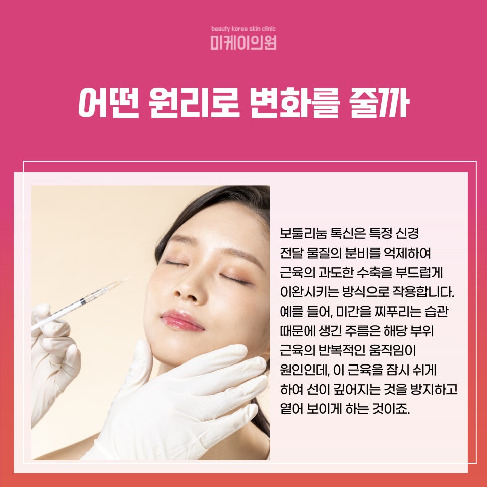 강남역 보톡스 효과 지속기간 알아보기 관련 이미지 2