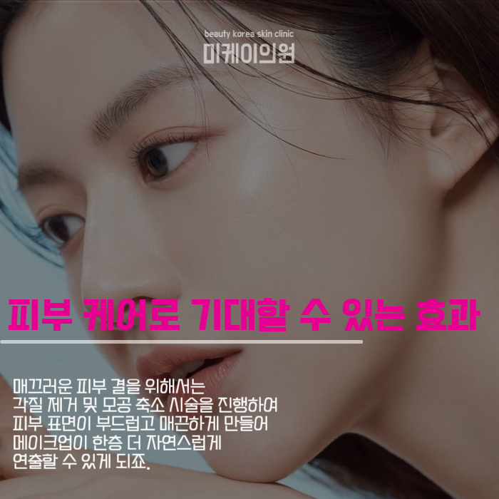 결혼식 전 피부과 시술 필수인 이유 관련 이미지 4