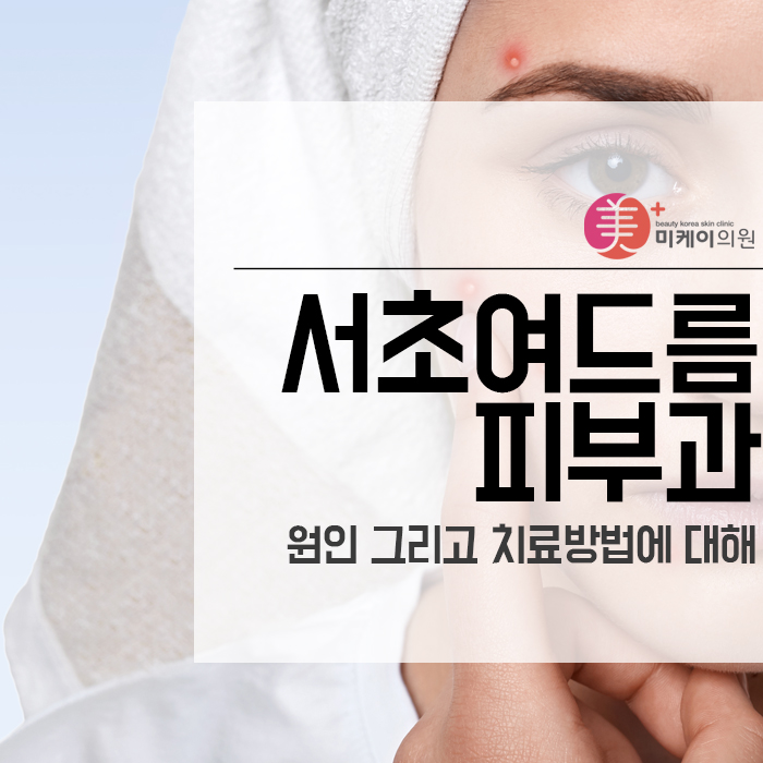 서초여드름의원 원인 그리고 치료방법에 대해 관련 이미지 1