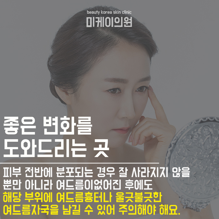 강남역여드름관리 이제 더 스마트하게! 관련 이미지 3
