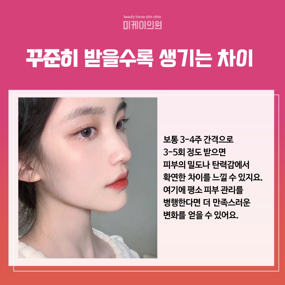 The Trending Treatment Recommended by Gangnam Dermatology Clinics: Onda Lifting image 5