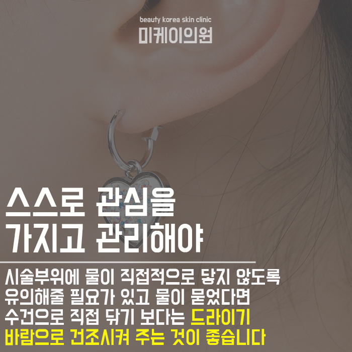 귀뚫고연고 발라도되나요? 고민하지 마세요 관련 이미지 3
