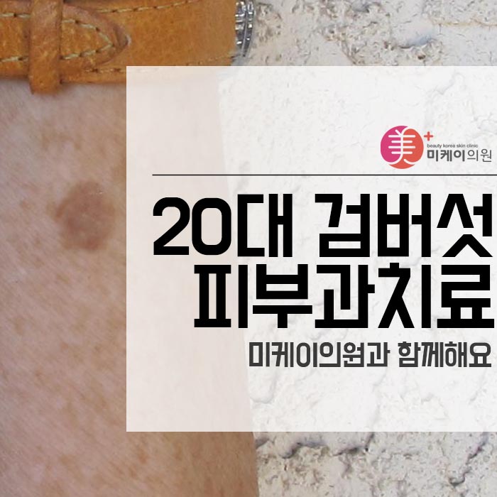 20대 검버섯 피부과치료 미케이의원과 함께해요 관련 이미지 1