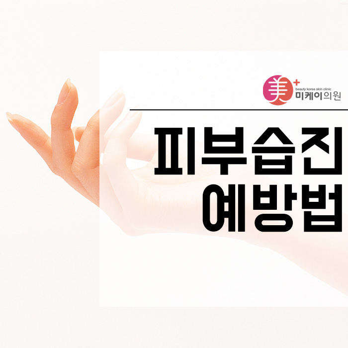 피부습진예방법 부드럽고 고운 손 만들기 관련 이미지 1