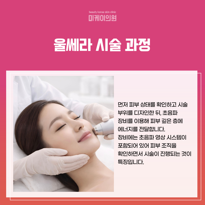 서초 울쎄라 병원 리프팅 시술의 원리와 효과 관련 이미지 4