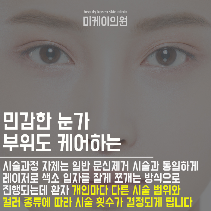 강남반영구문신제거 디테일한 케어 관련 이미지 3