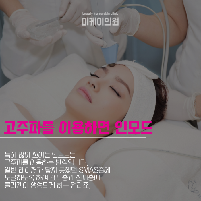 처진얼굴리프팅 이런 방법은 어때요 관련 이미지 3