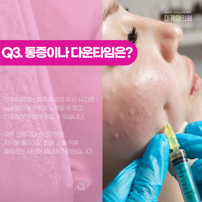 강남 리쥬란힐러, 왜 관련 이미지 4
