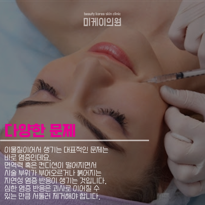 팔자주름필러 부작용 없다고 할 순 없죠 관련 이미지 2