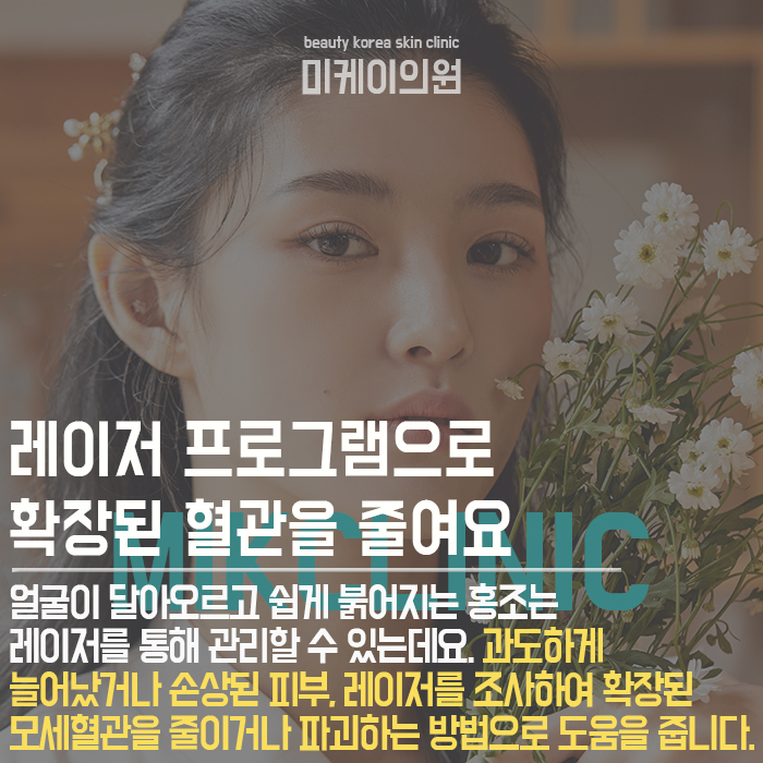 안면홍조예방하는방법 만성화가 되기 전에 관련 이미지 5