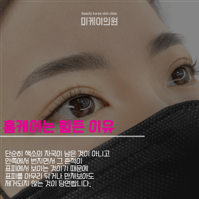 눈썹문신 잔흔없애는법 너무 신경 쓰인다면 관련 이미지 4