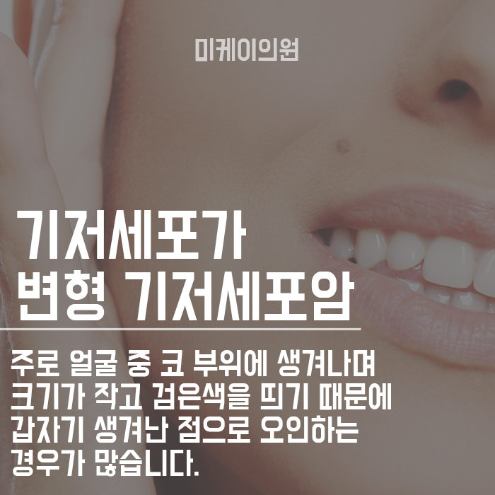 피부암초기증상 잘 읽어보고 초기에 대처해요 관련 이미지 2