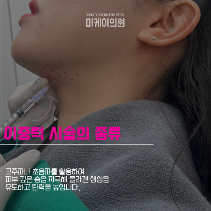 강남 이중턱관리 하나로 자신감 되찾기 관련 이미지 4