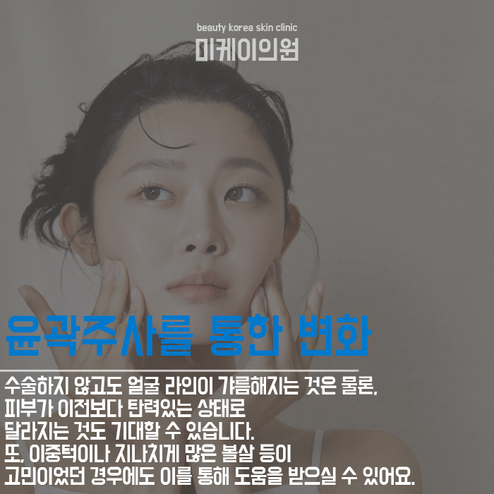 시술과수술차이 그리고 다양한 쁘띠시술 관련 이미지 3
